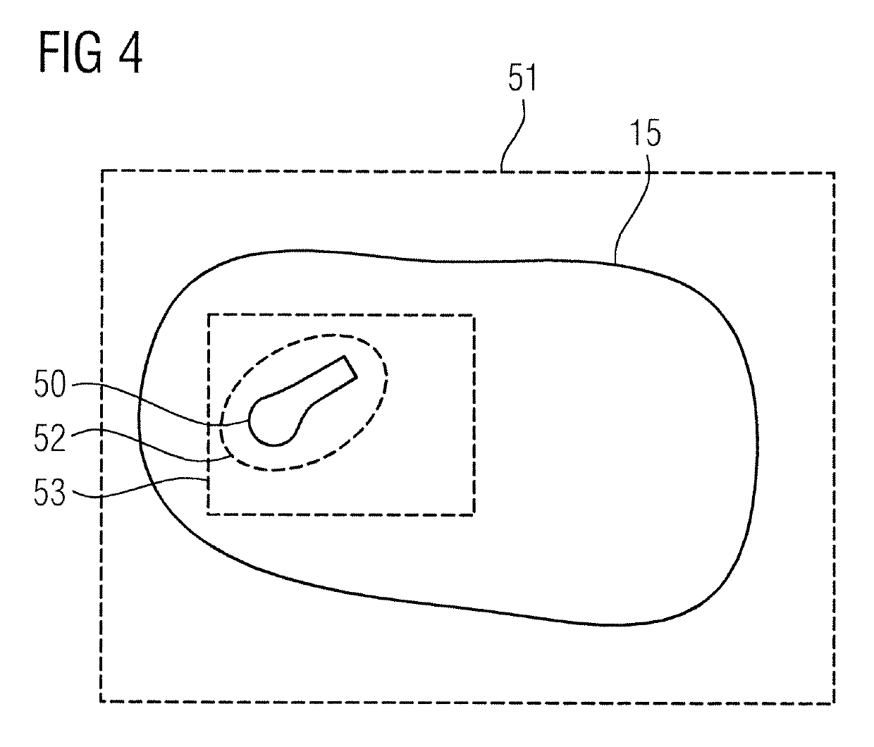 Method and apparatus for attenuation correction of emission tomography scan data