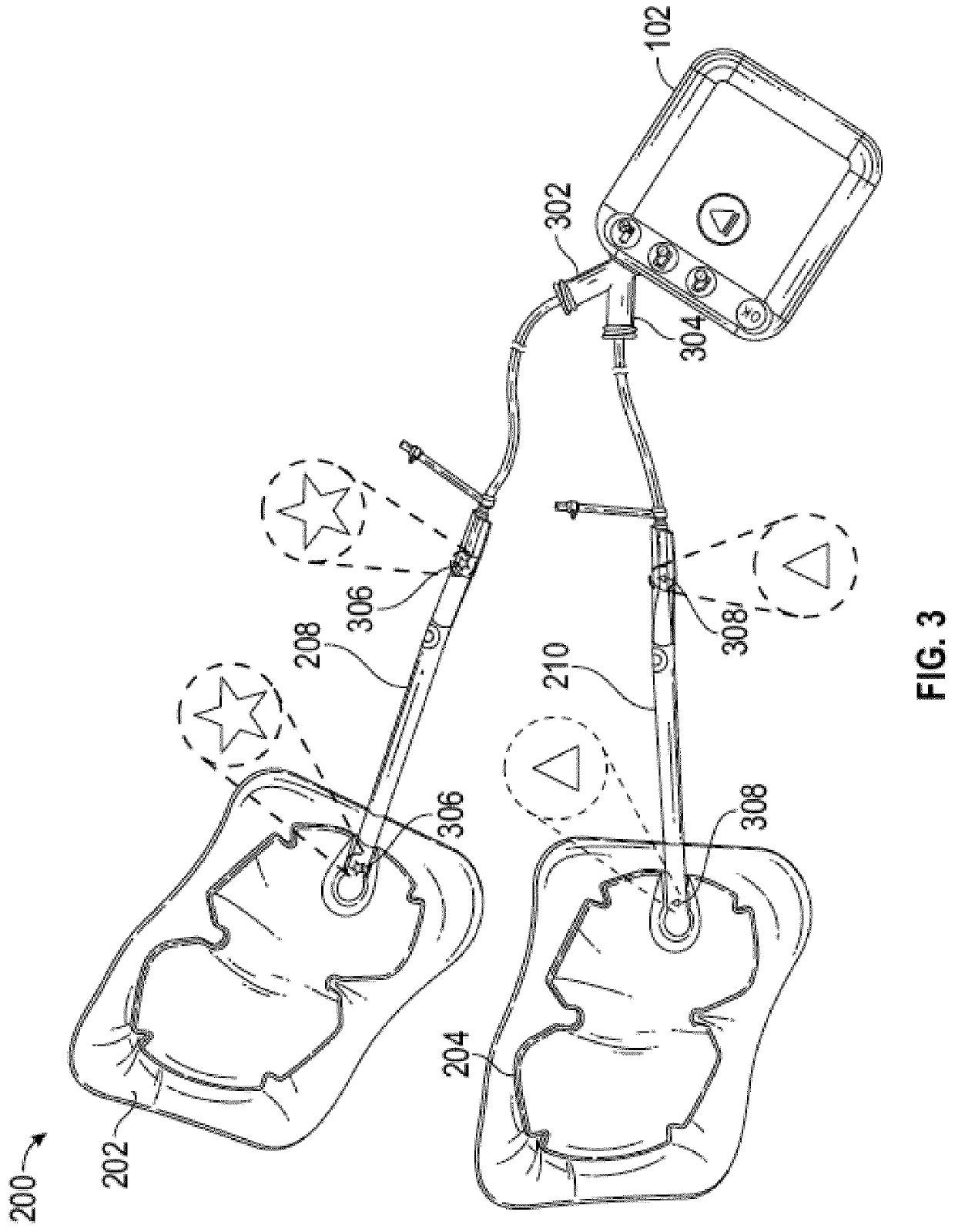 Multiple dressing negative pressure wound therapy system