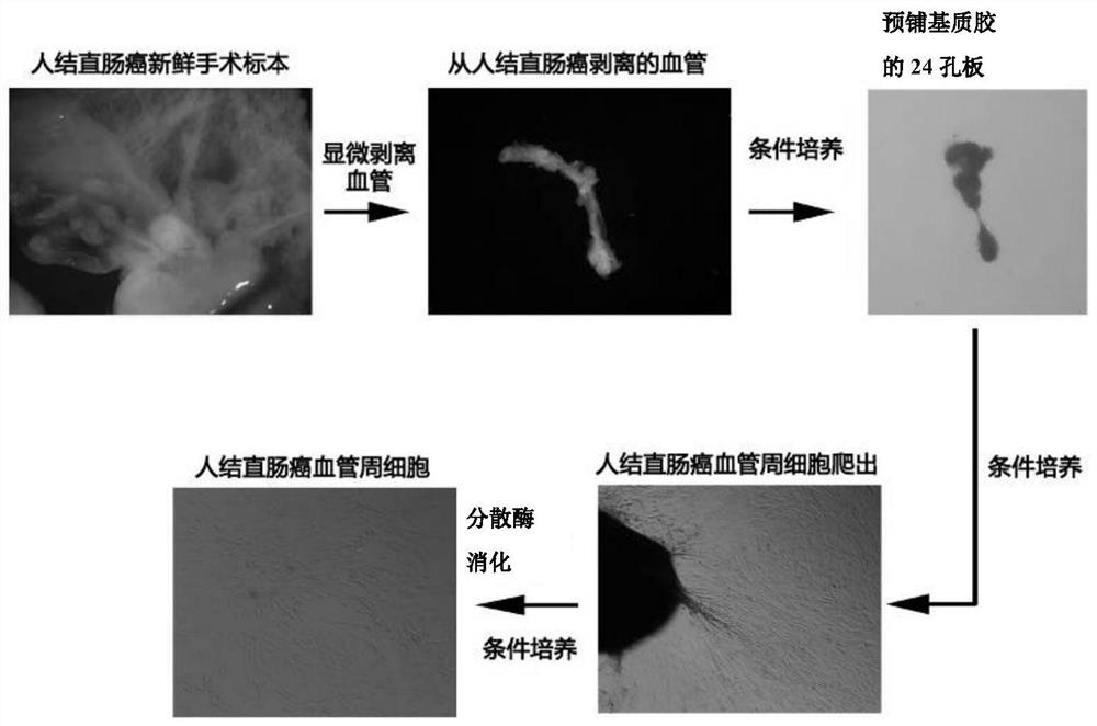 Tumor perivascular cell as well as separation method and application thereof