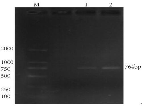 Soybean subtilisin gene and its application