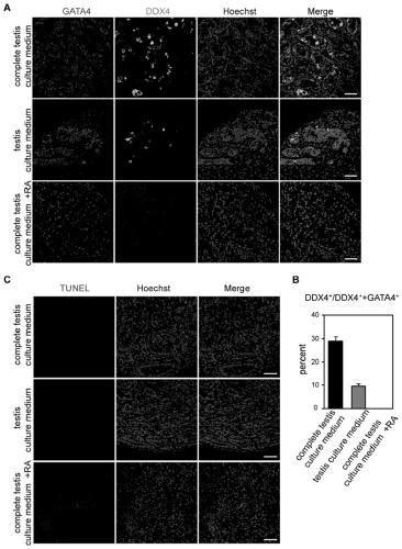 Preparation method of in-vitro human testicular spermatogenesis model