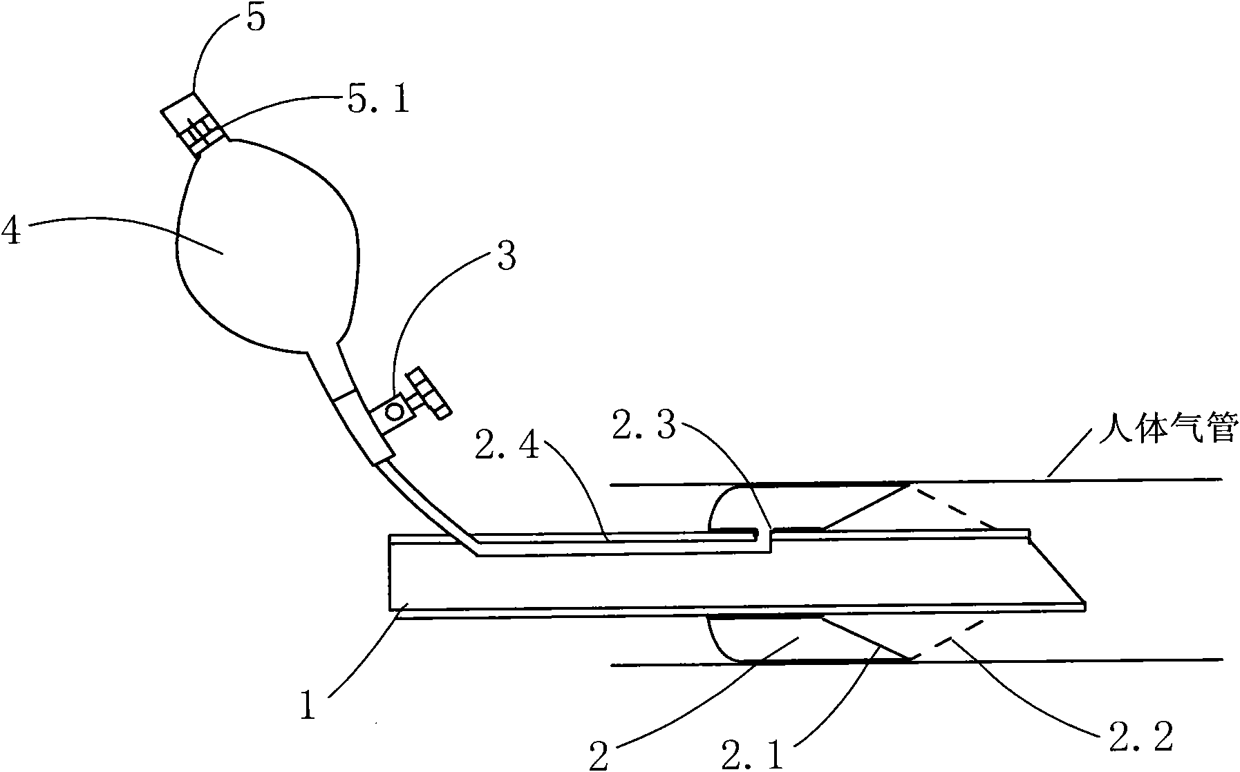 Umbrella-shaped cuff trachea cannula