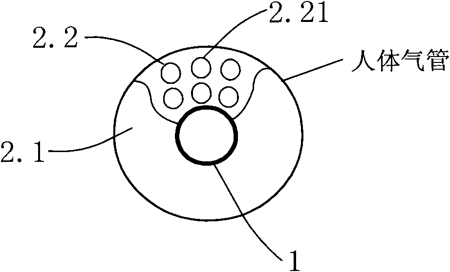 Umbrella-shaped cuff trachea cannula