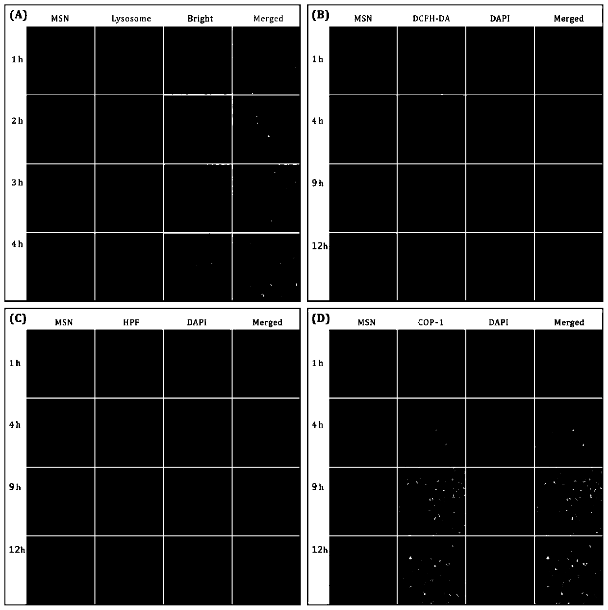 Tumor-targeted nanomedicine and application and preparation method