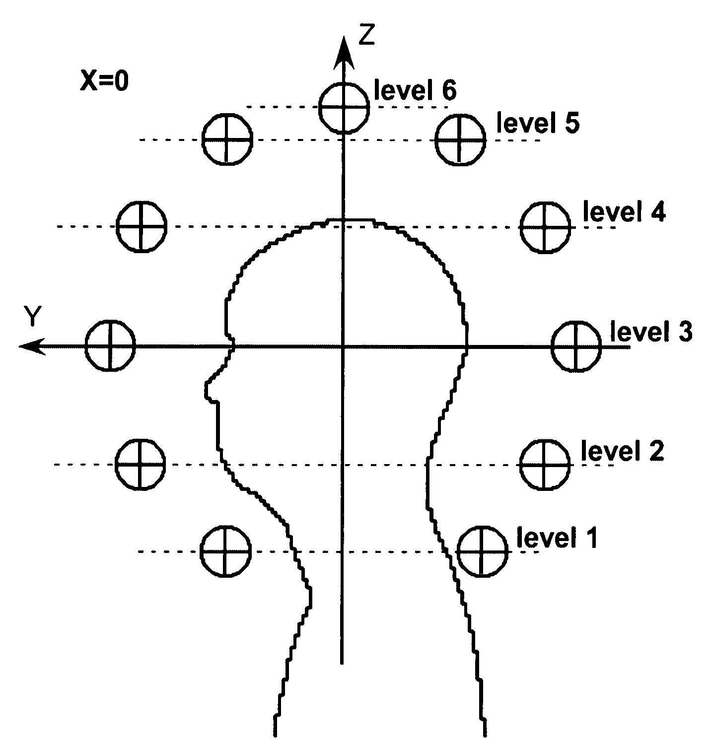 RF coil for a highly uniform B1 amplitude for high field MRI