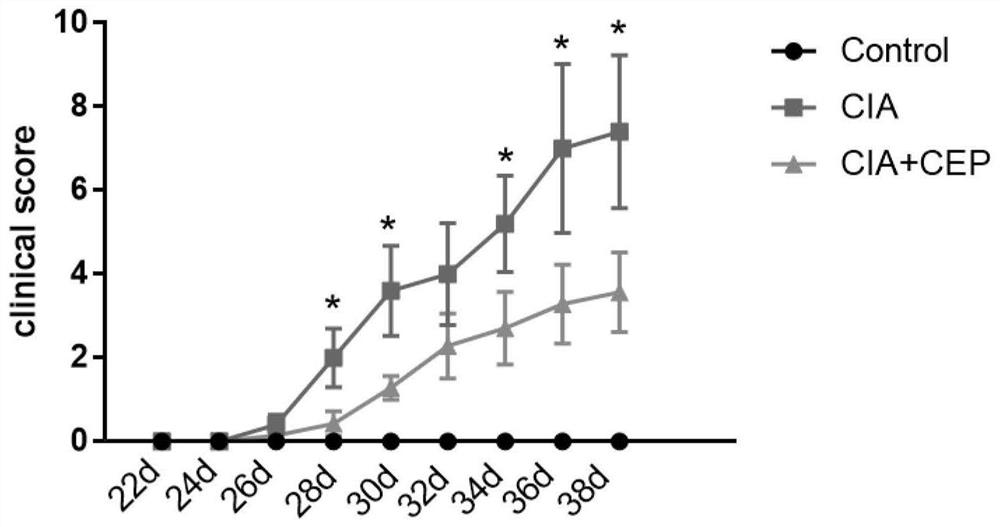 Application of cepharanthine in preparation of medicine for treating rheumatoid arthritis