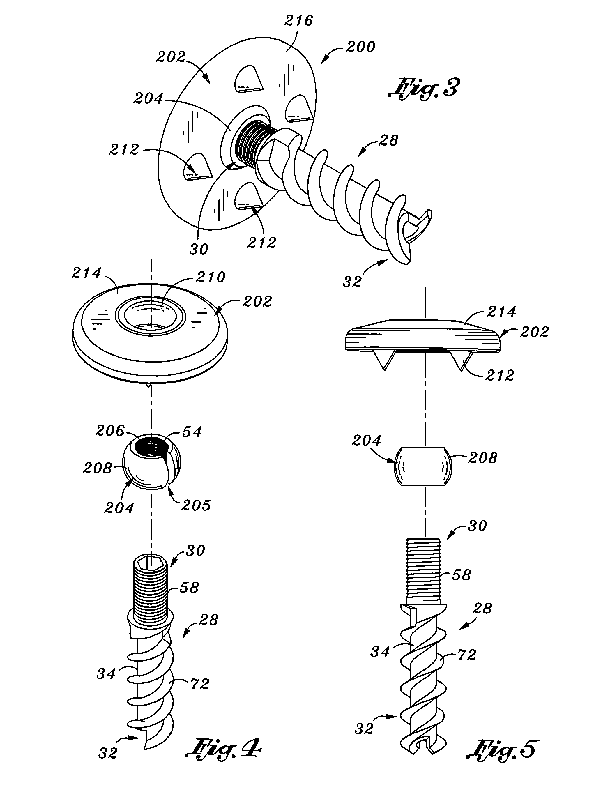 Soft tissue anchor and method of using same