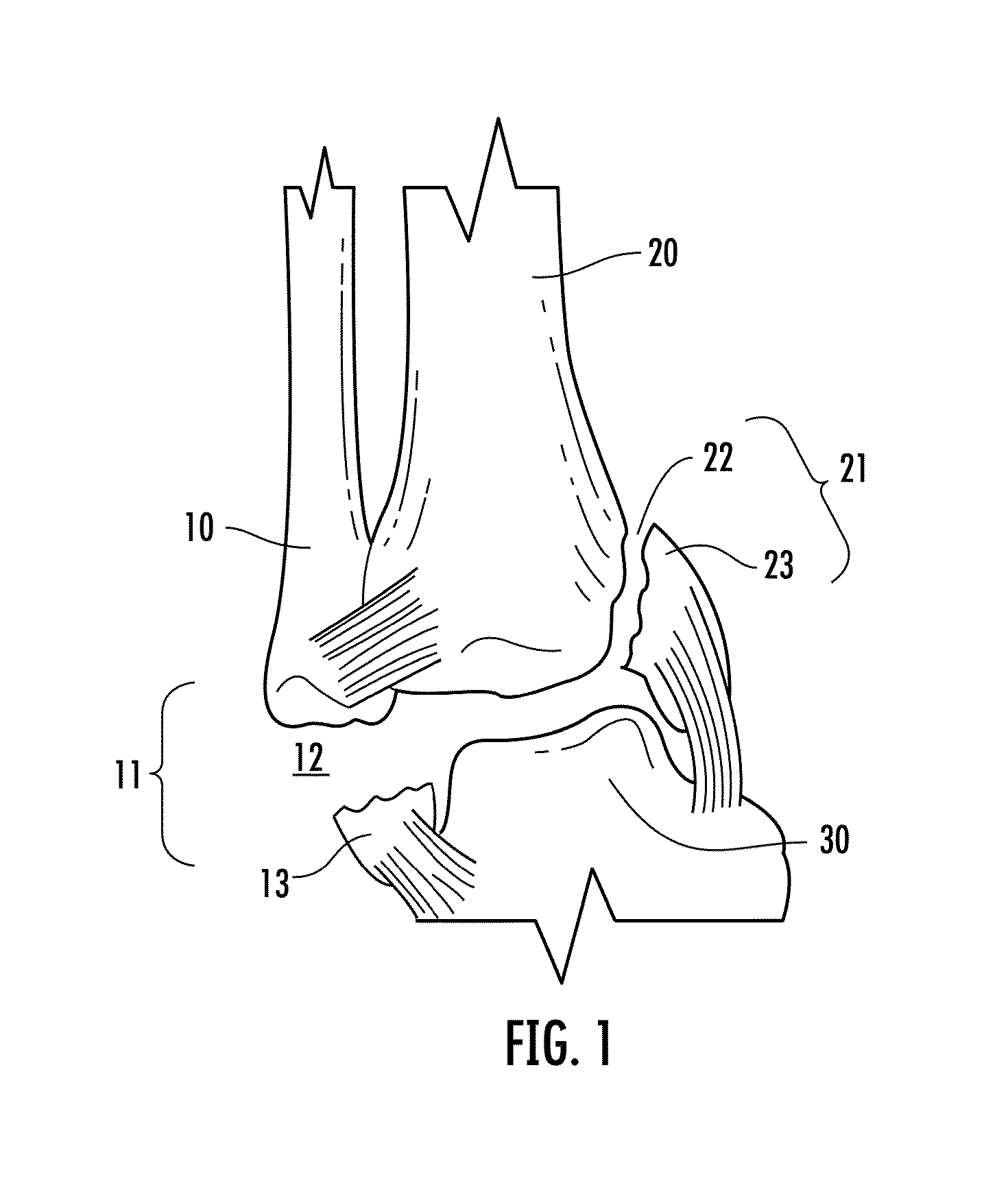 Holder/impactor for contoured bone plate for fracture fixation