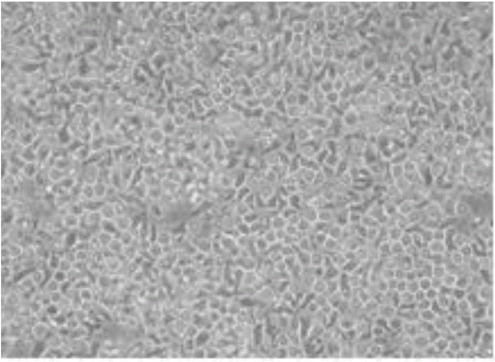 Cryopreservation liquid for cultured NK cells and preparation method of cryopreservation liquid