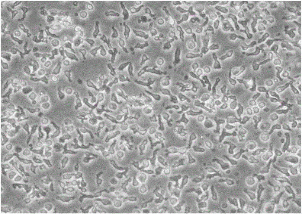 Cryopreservation liquid for cultured NK cells and preparation method of cryopreservation liquid