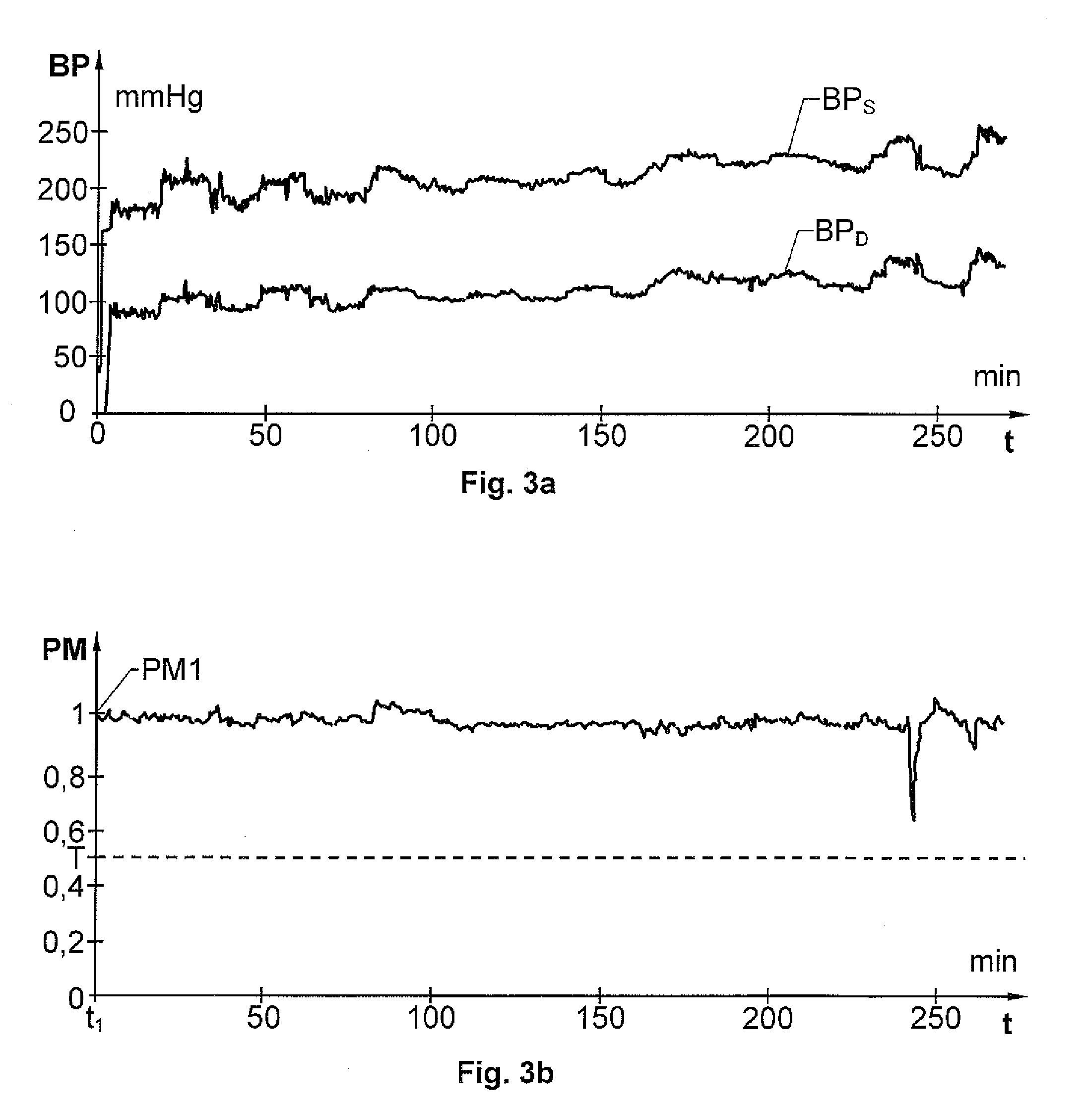 Prediction of Rapid Symptomatic Blood Pressure Decrease