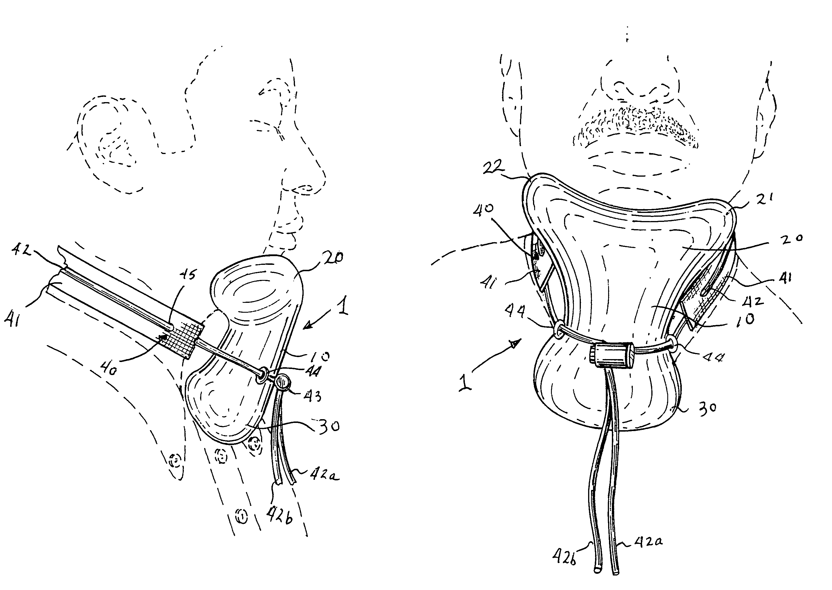 Extended interfaced, under and around chin, head support system for resting while sitting