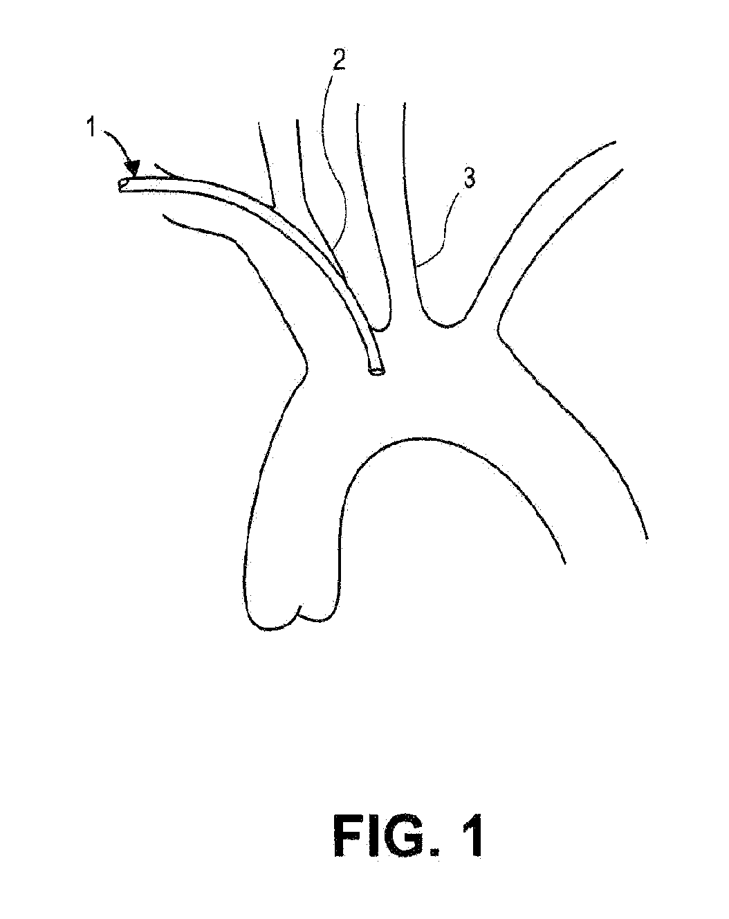Embolic protection device for protecting the cerebral vasculature