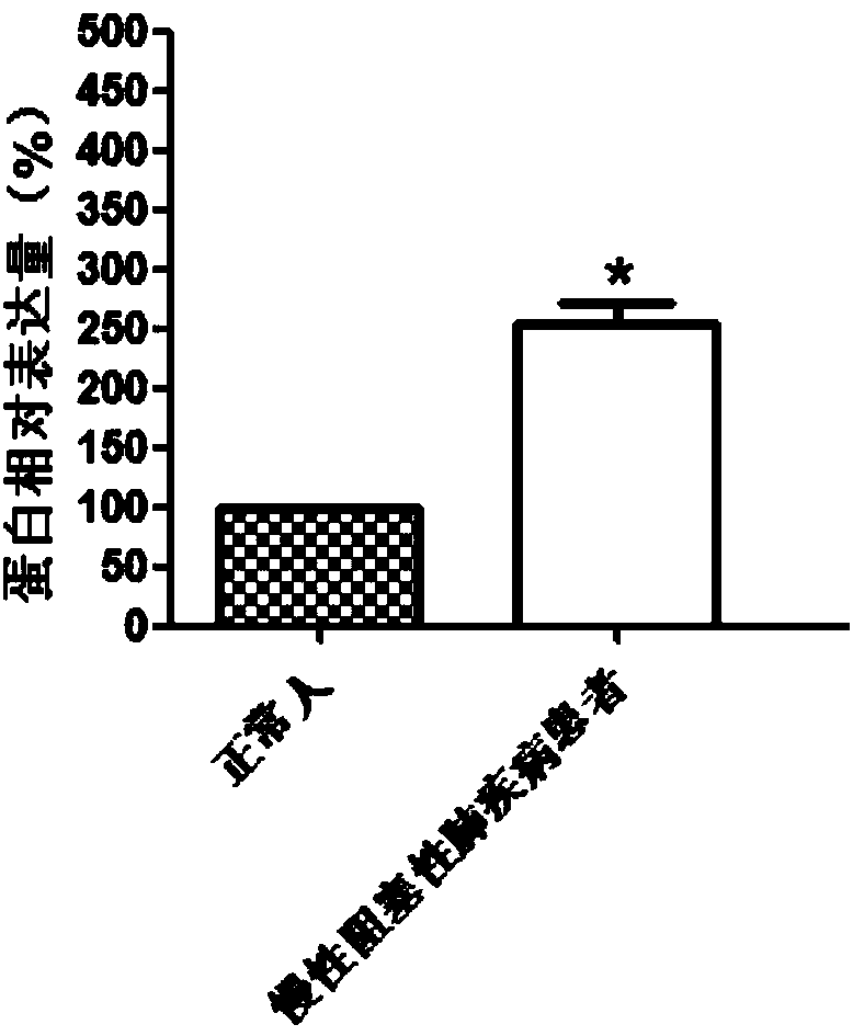 Molecular marker for diagnosing chronic obstructive pulmonary disease