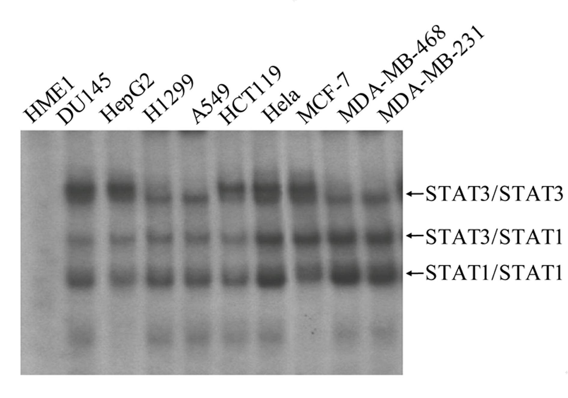 High-flux anti-tumor drug screening cell model based on STAT3 and NF-kB two-signal channel serving as target, as well as building and application of high-flux anti-tumor drug screening cell model