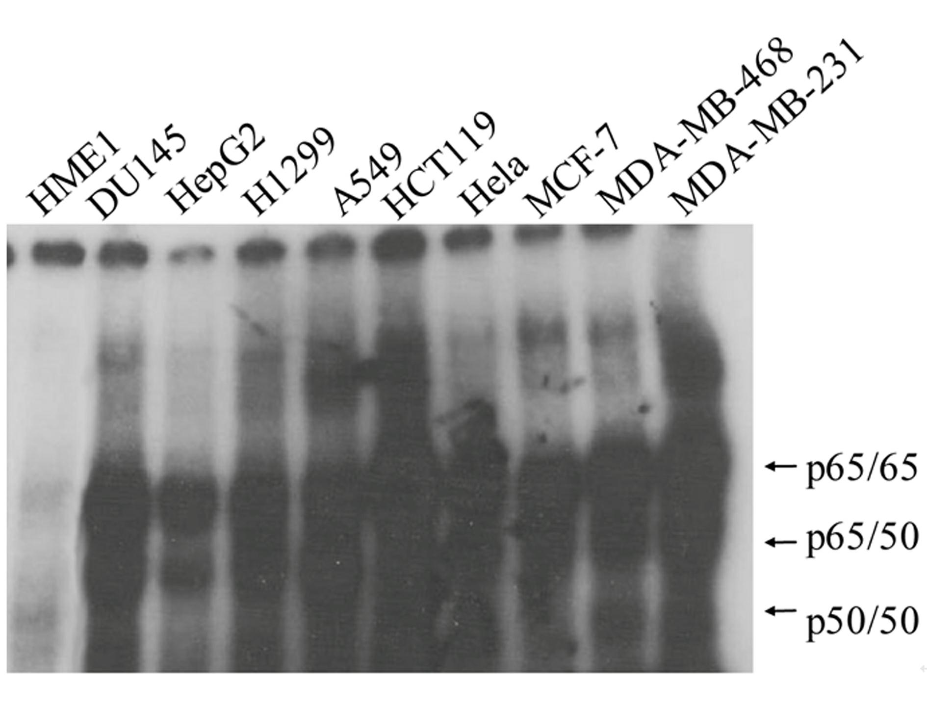 High-flux anti-tumor drug screening cell model based on STAT3 and NF-kB two-signal channel serving as target, as well as building and application of high-flux anti-tumor drug screening cell model