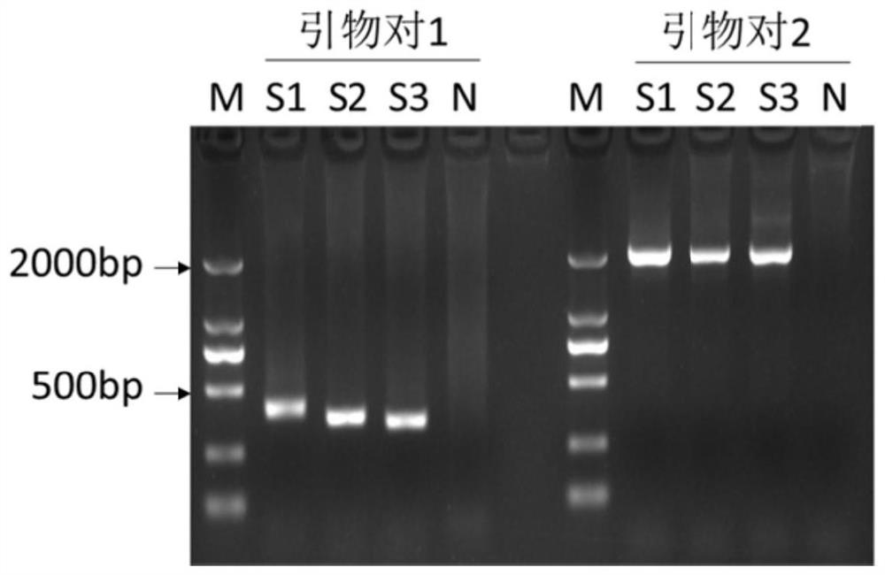 PCR detection kit for CTG region of atrophic myotonin protein kinase gene and application of PCR detection kit