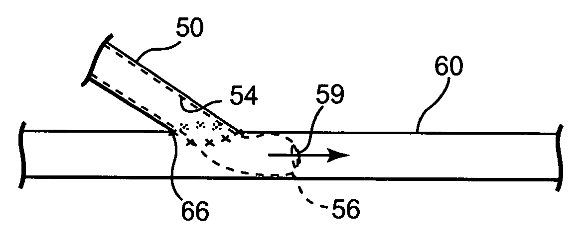 Transconduit perfusion catheter