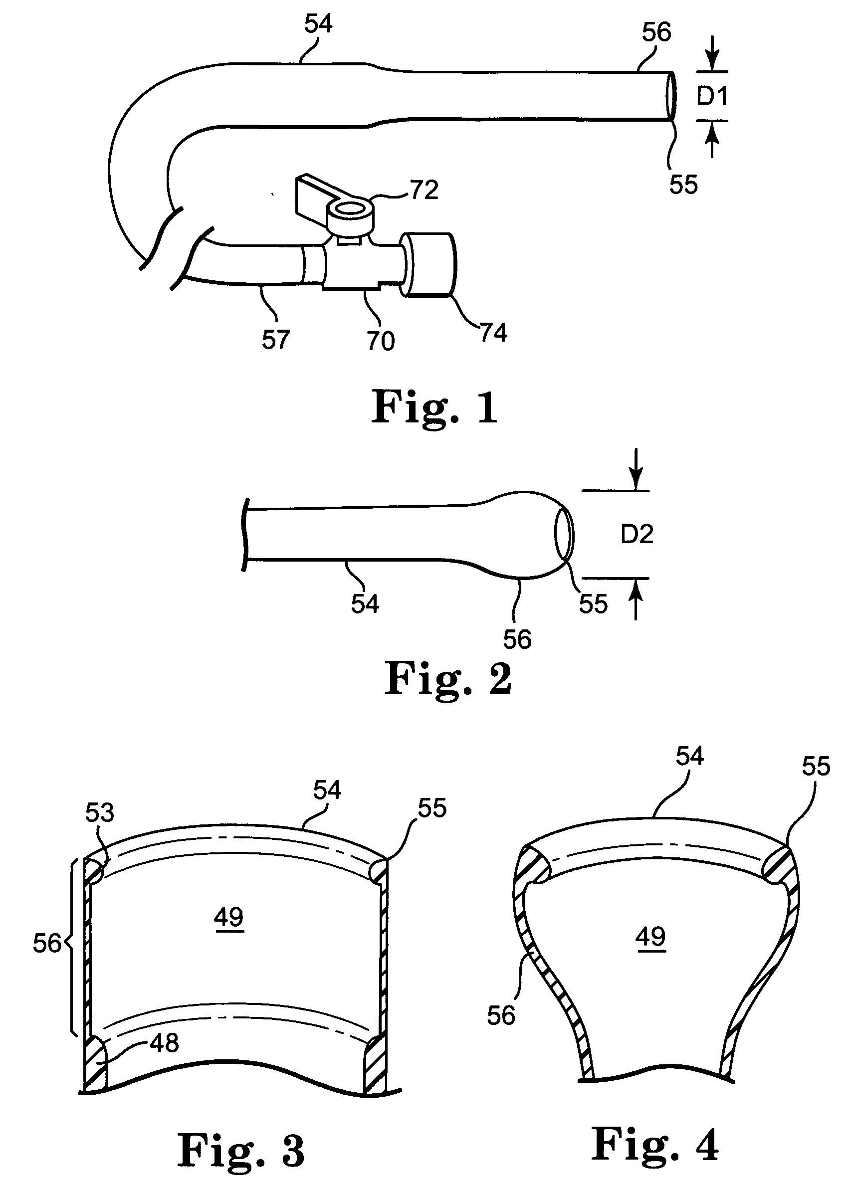 Transconduit perfusion catheter