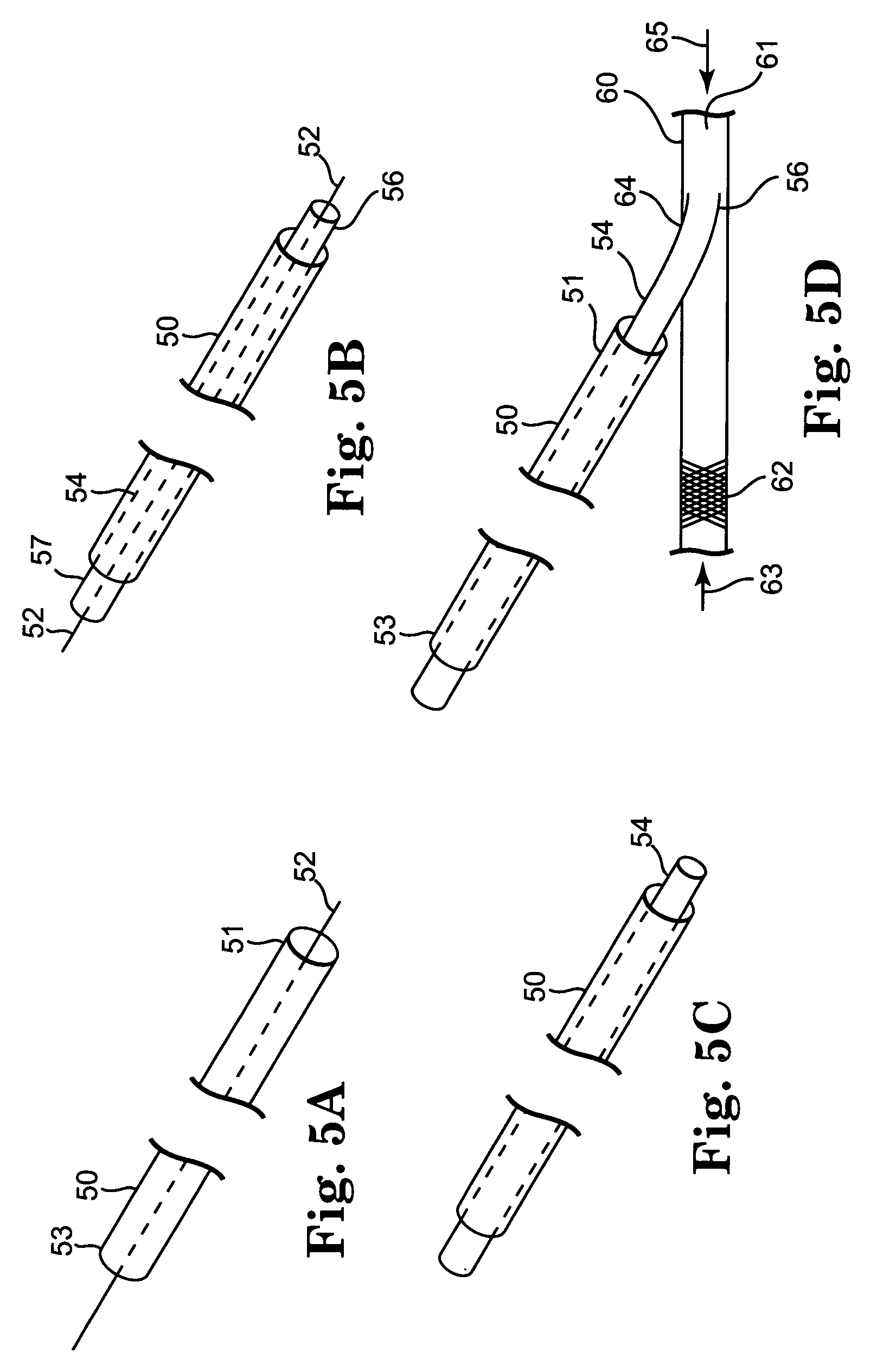 Transconduit perfusion catheter