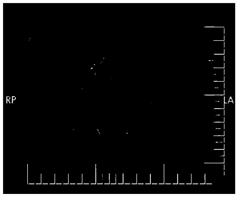 Medical image data rapid auxiliary labeling and storage method and system