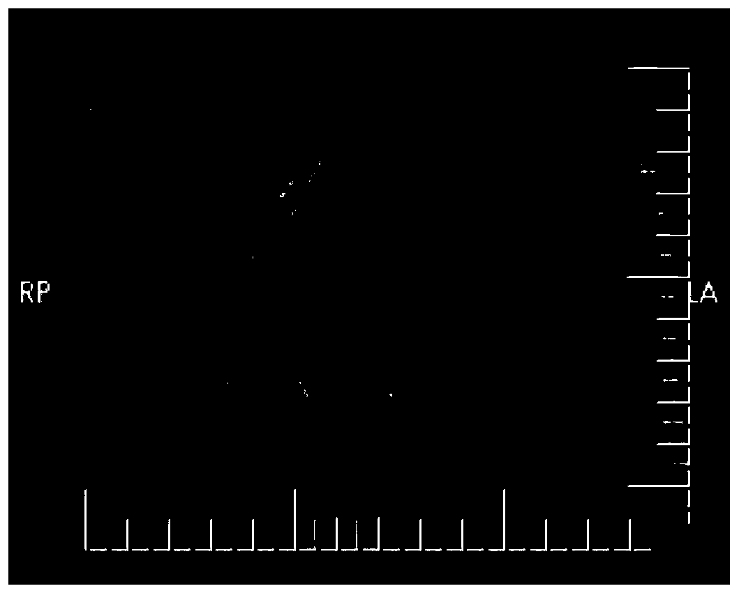 Medical image data rapid auxiliary labeling and storage method and system