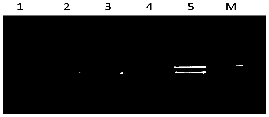 Method for quickly detecting zucchini yellow mosaic virus of siraitia grosvenorii