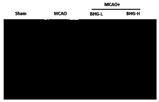 Application of baohuoside I in preparation of drug for preventing and treating cerebral arterial thrombosis