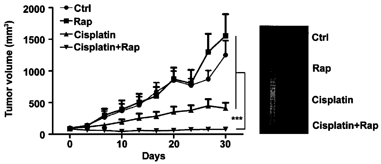 Novel tumor targeted therapy polypeptide and application thereof