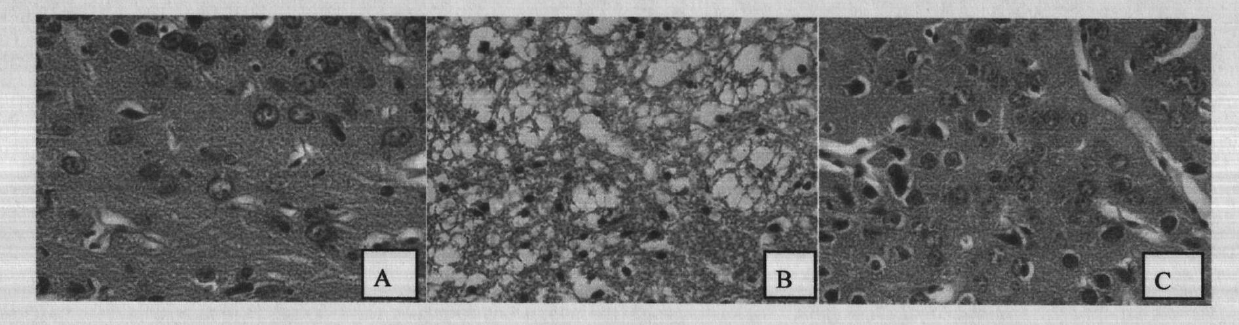 Application of curcumin to preparation of drugs for treating cerebral ischemia/reperfusion injuries