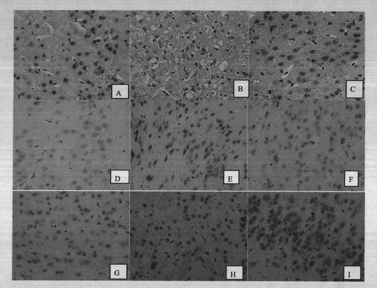 Application of curcumin to preparation of drugs for treating cerebral ischemia/reperfusion injuries