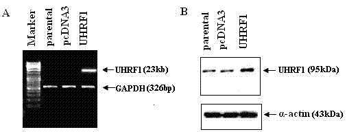 Biomarker reagent used for detecting breast cancer state