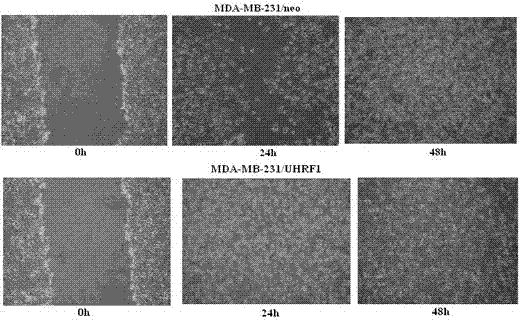 Biomarker reagent used for detecting breast cancer state