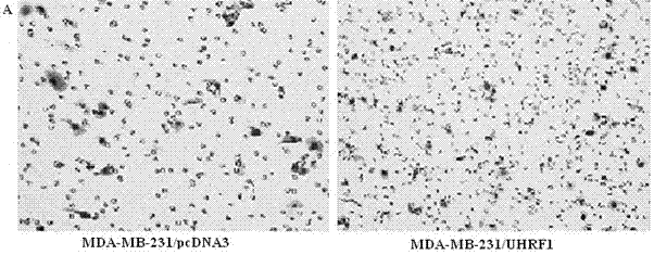 Biomarker reagent used for detecting breast cancer state