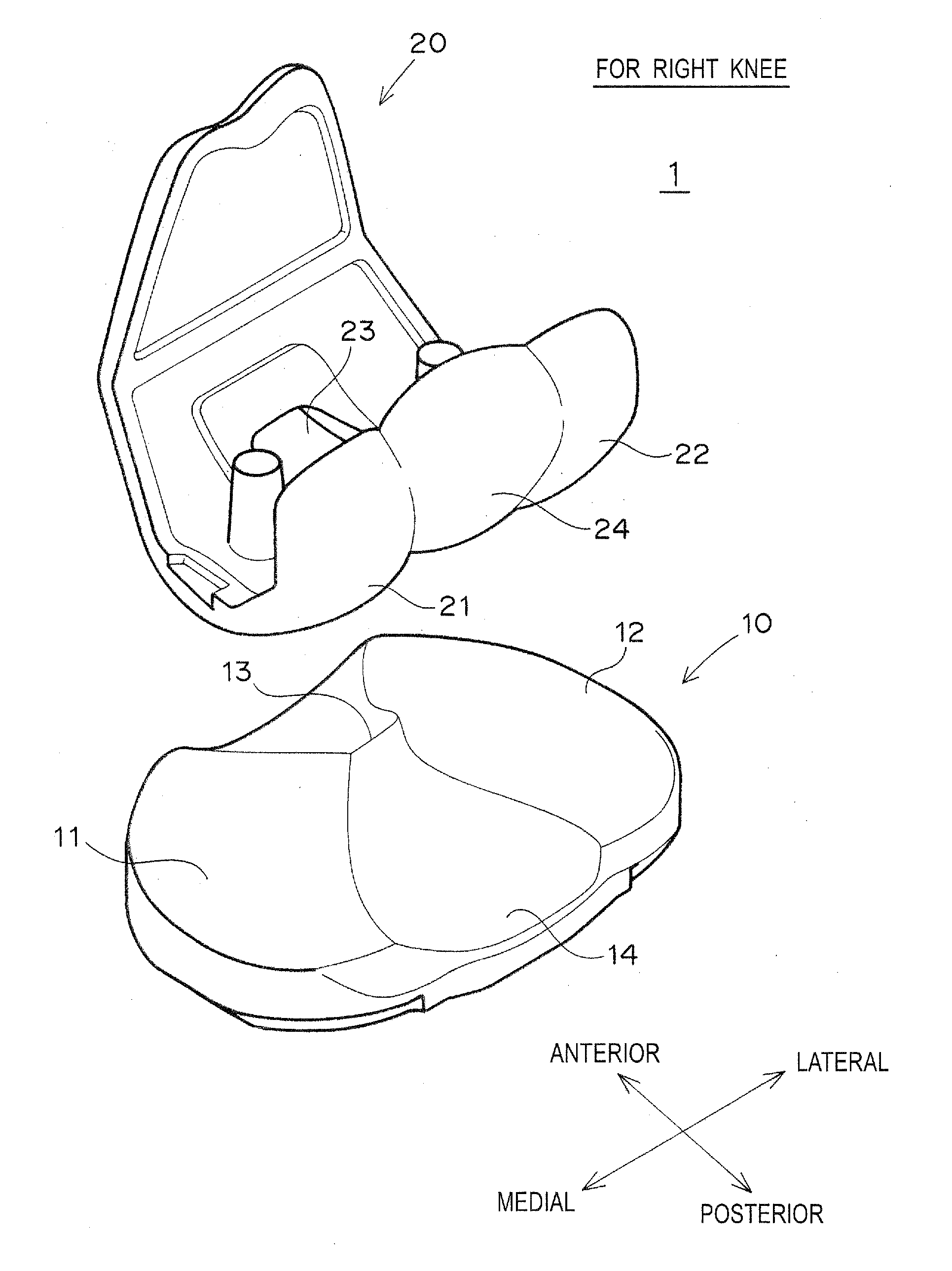 Artificial knee joint