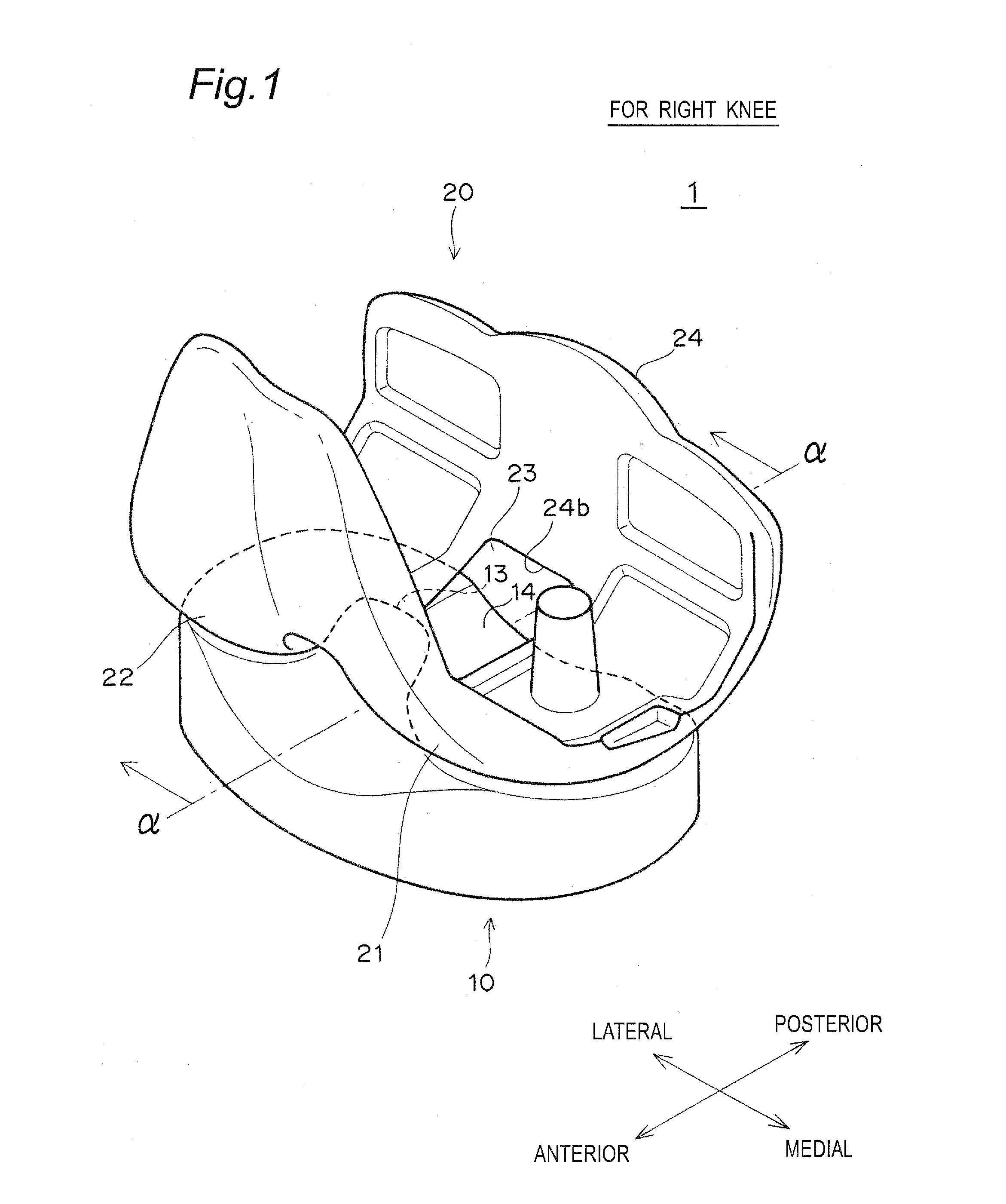 Artificial knee joint