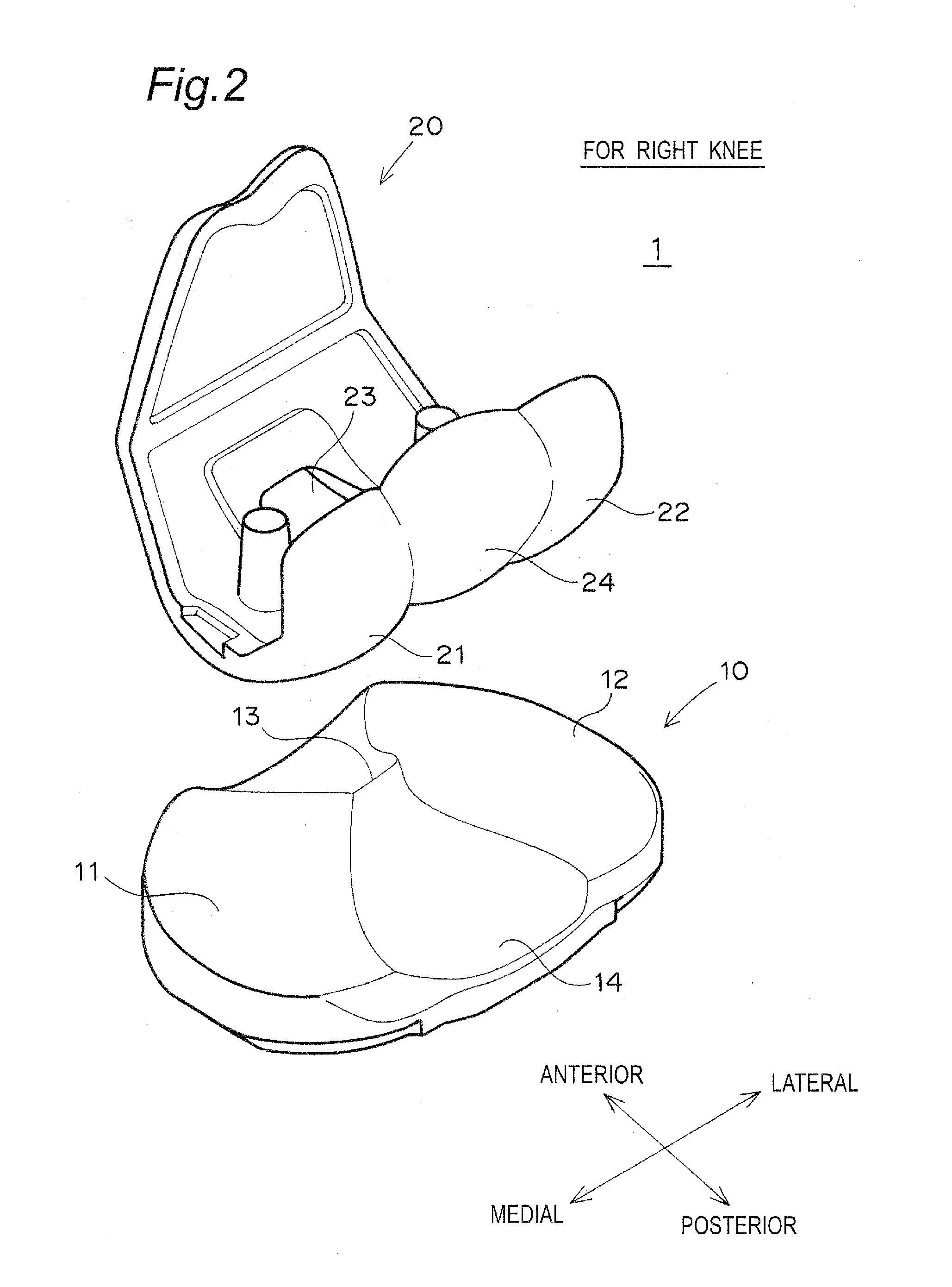 Artificial knee joint