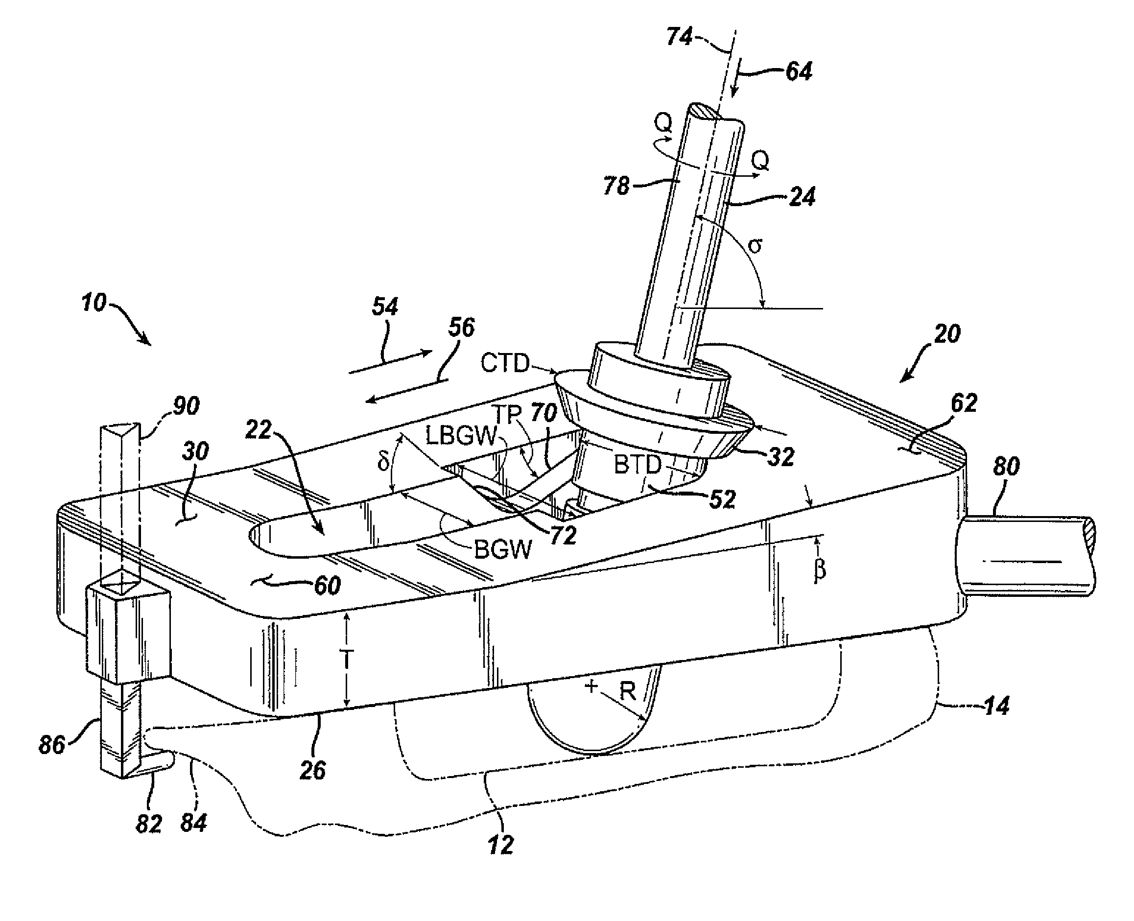 Method for removal of bone