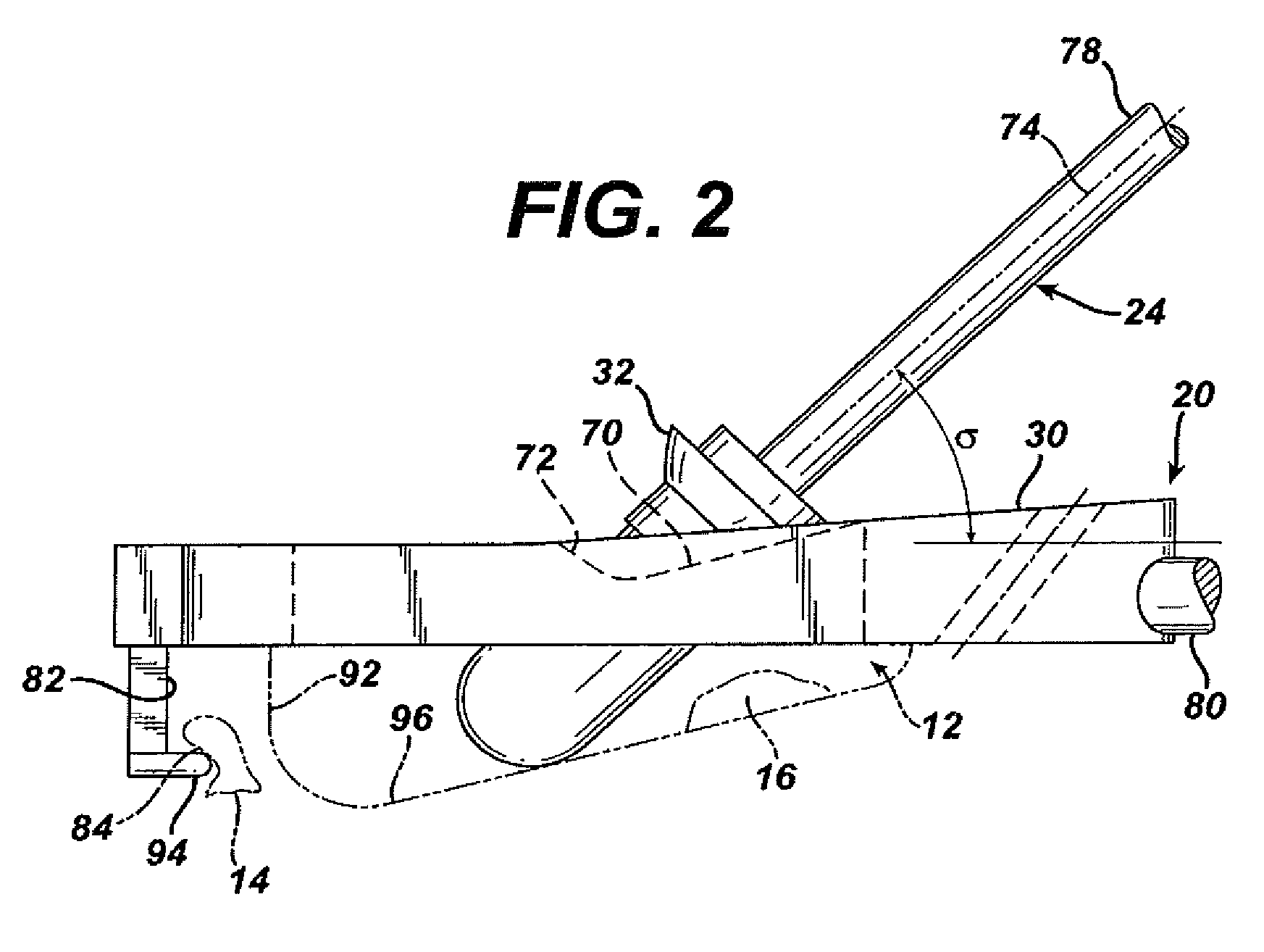 Method for removal of bone