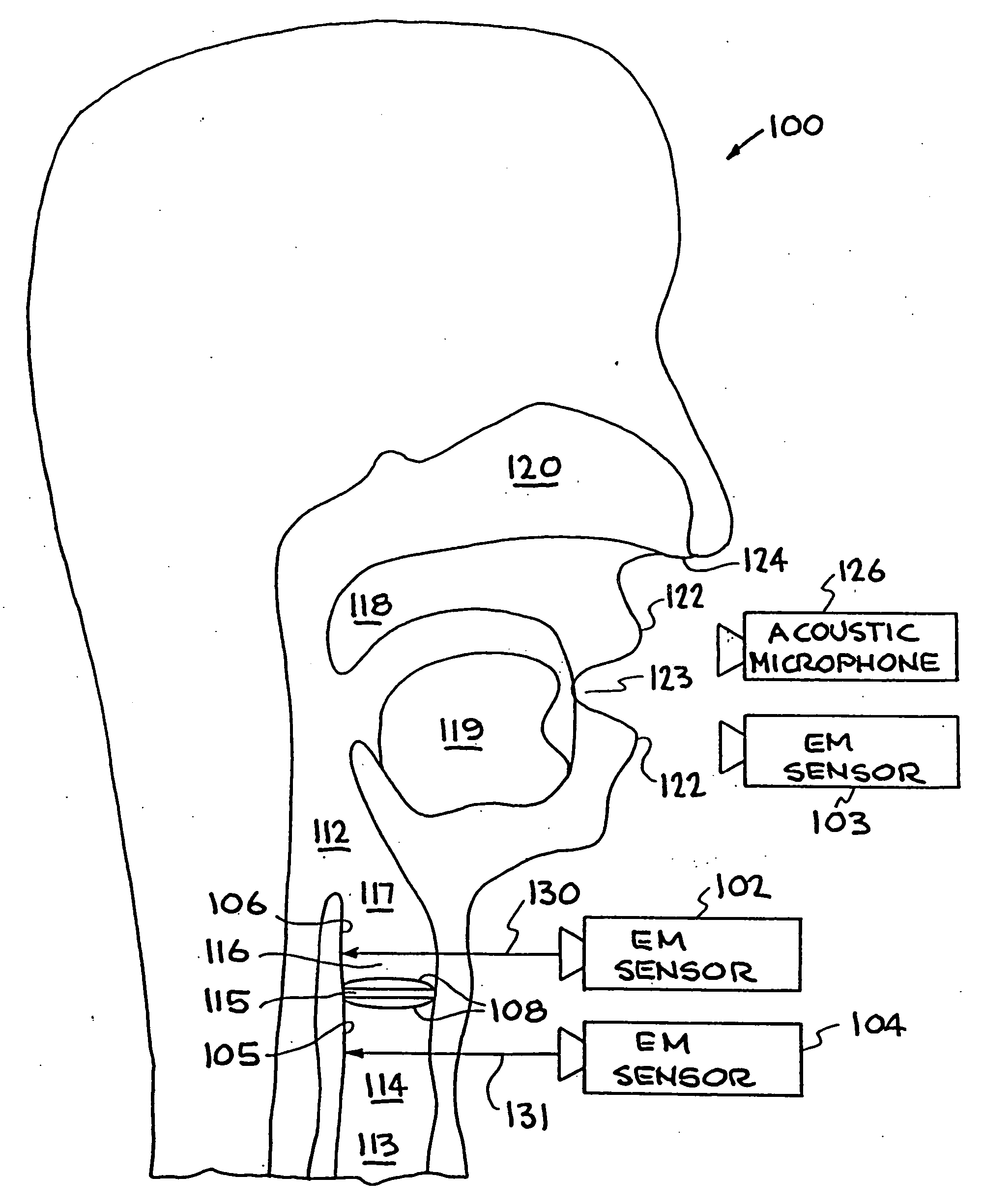 System and method for characterizing voiced excitations of speech and acoustic signals, removing acoustic noise from speech, and synthesizing speech