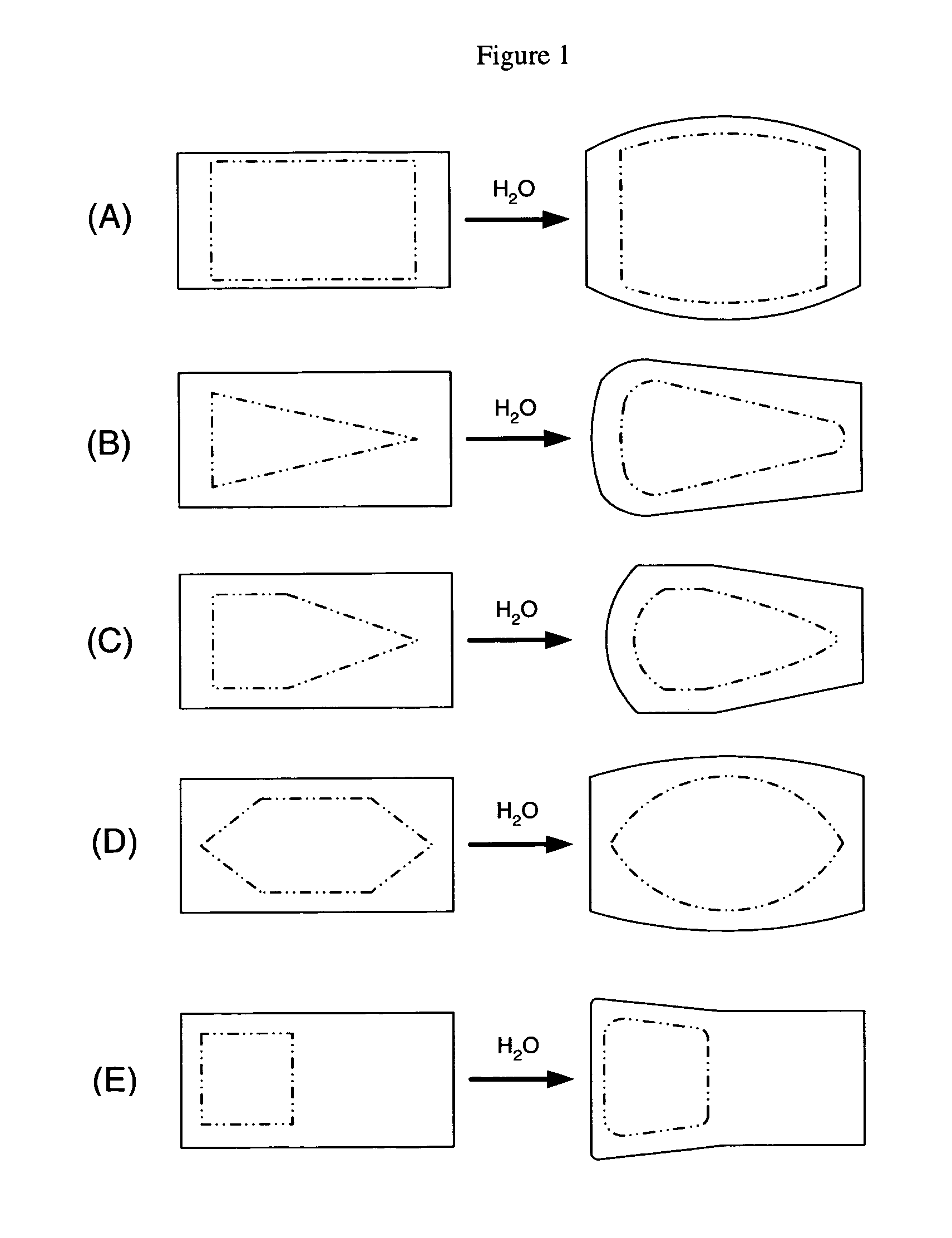 Selectively expandable composite structures for spinal arthroplasty