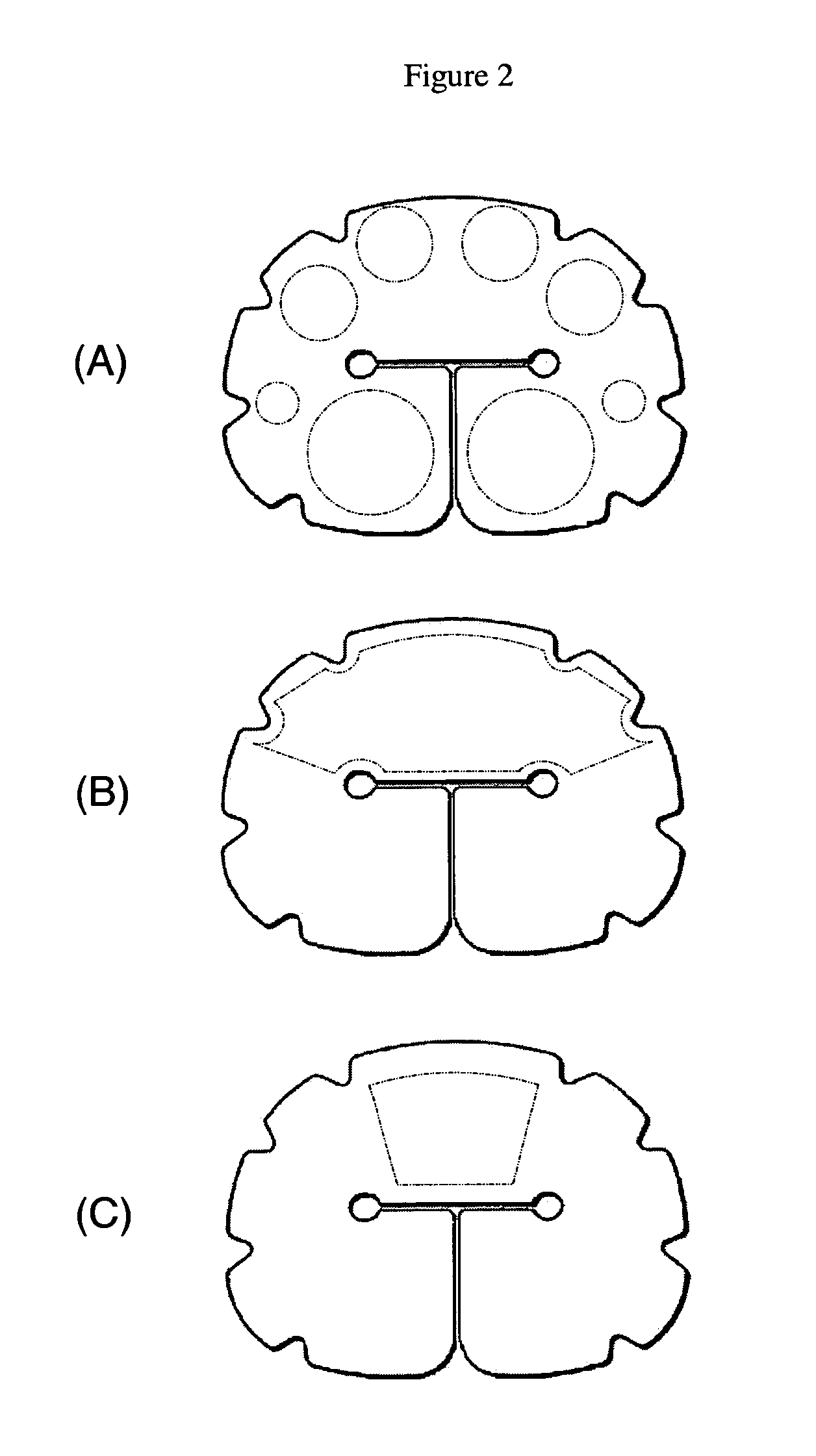 Selectively expandable composite structures for spinal arthroplasty