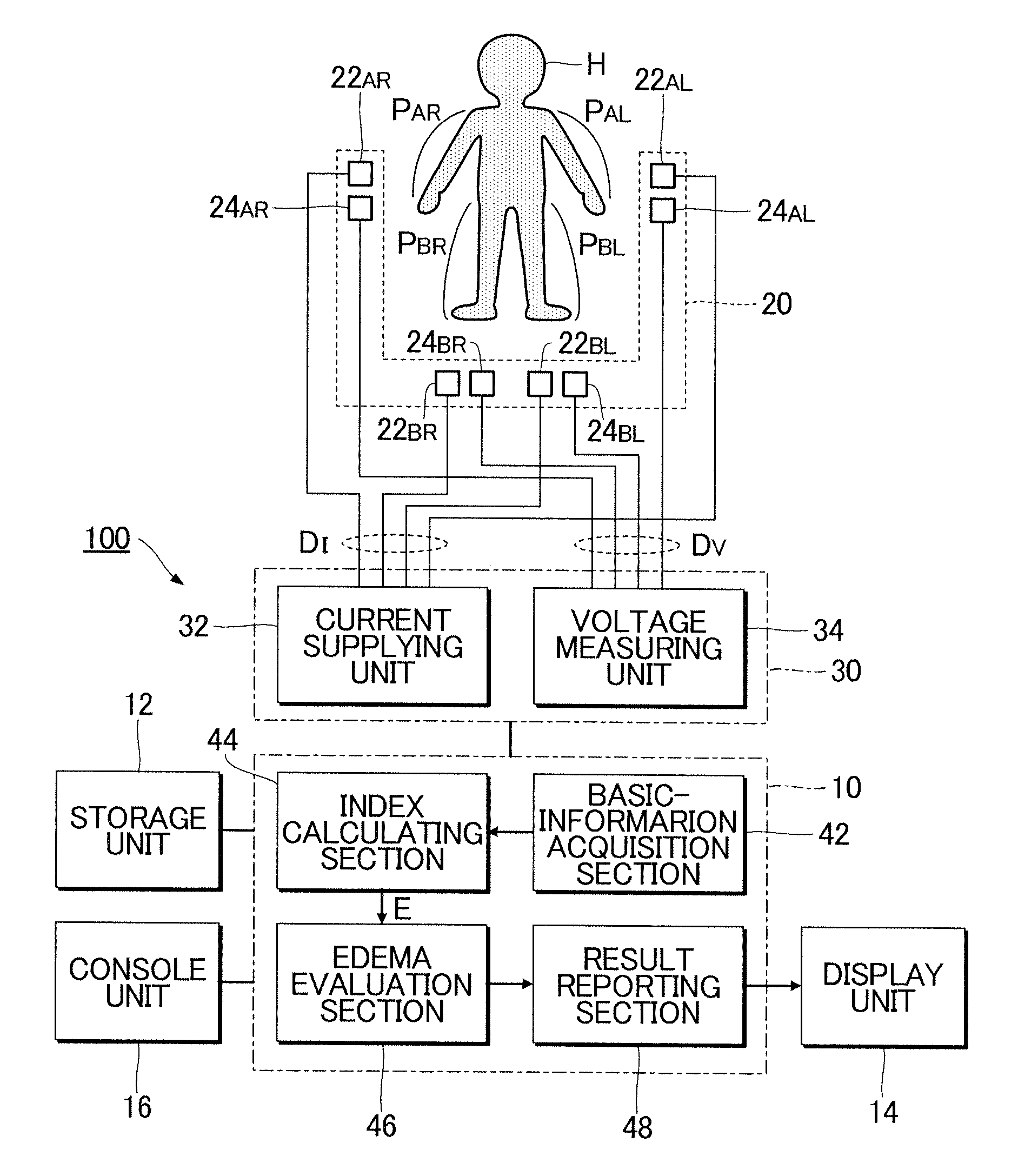 Edema evaluation apparatus