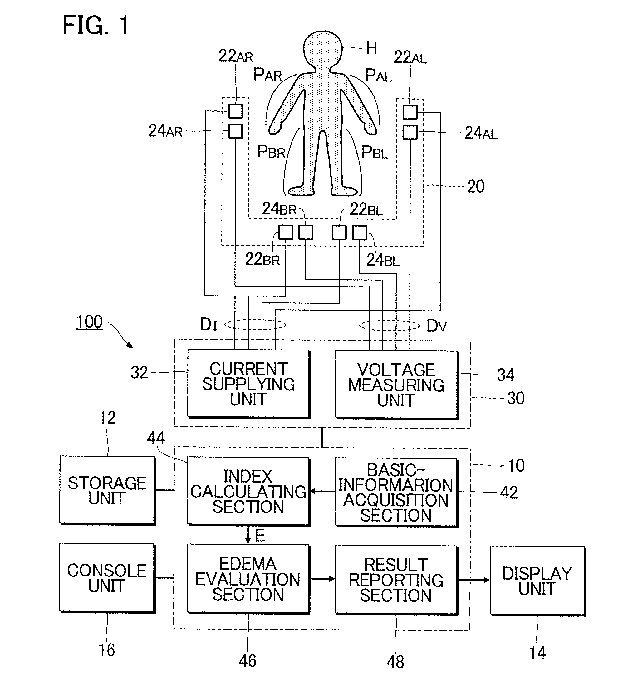 Edema evaluation apparatus