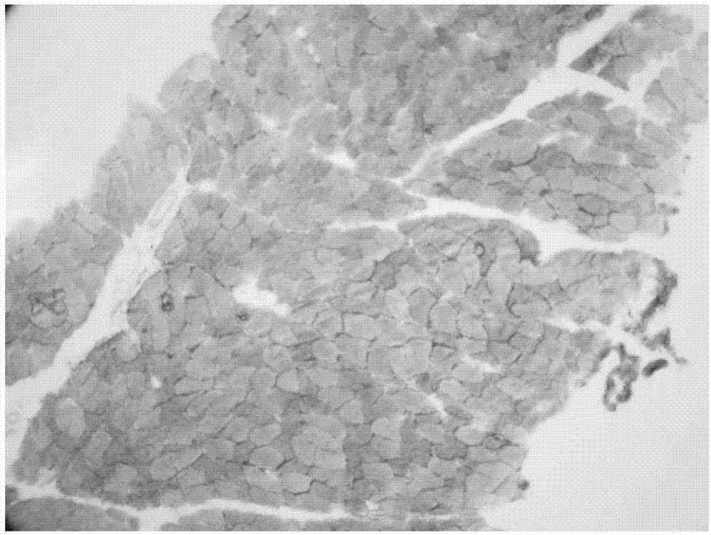 Dyeing method for tissue glycogen