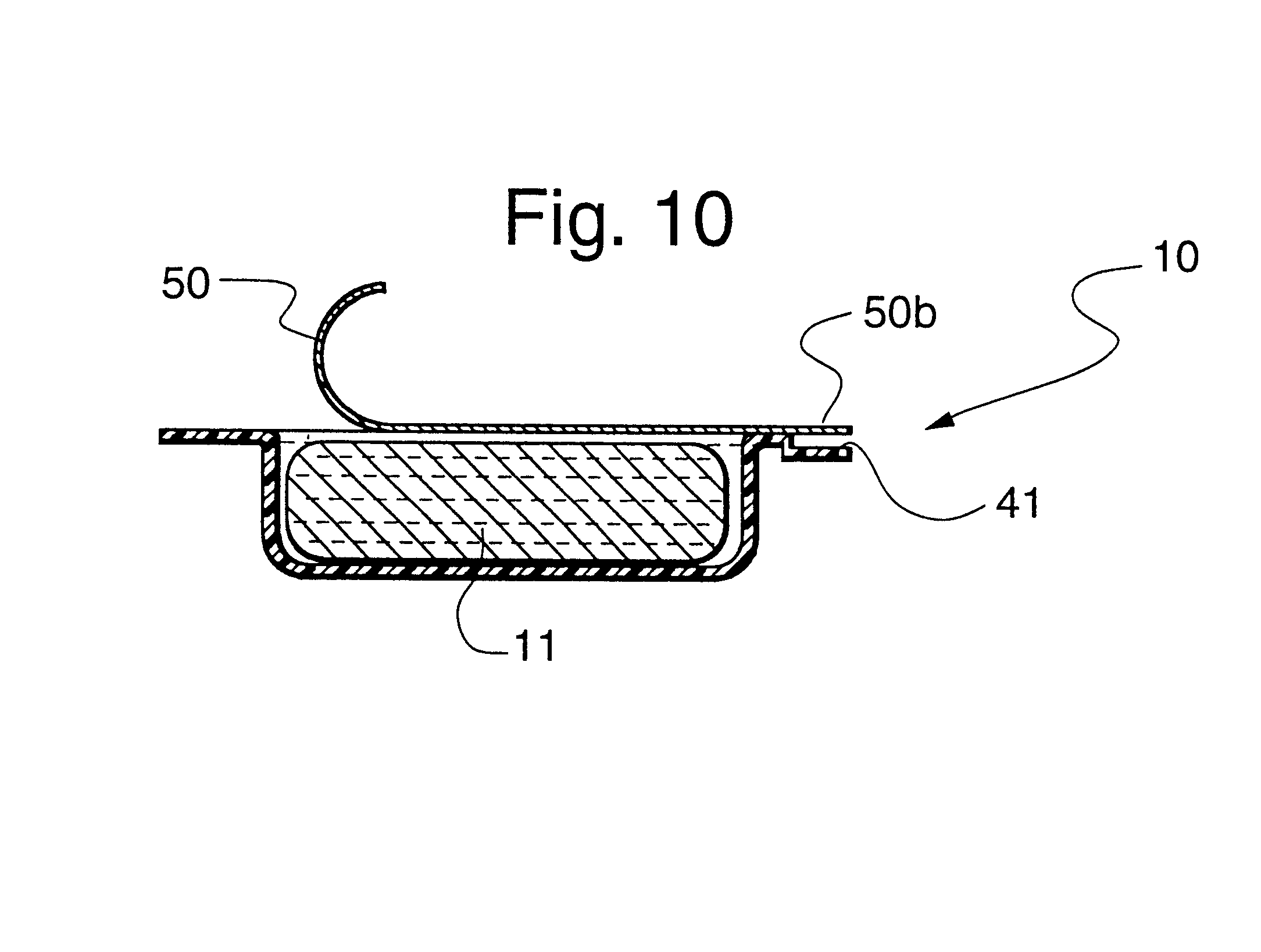 Dental composite restorative material and method of restoring a tooth