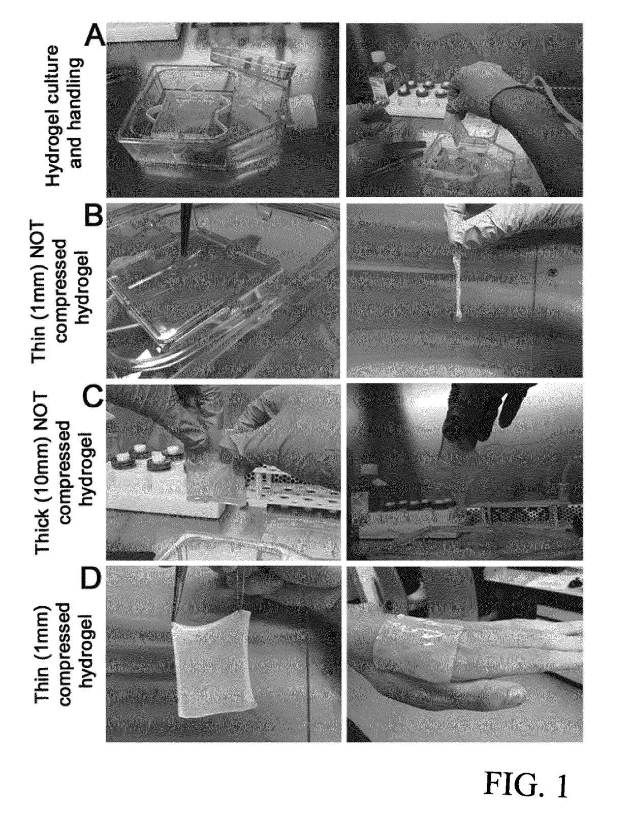 Tissue graft