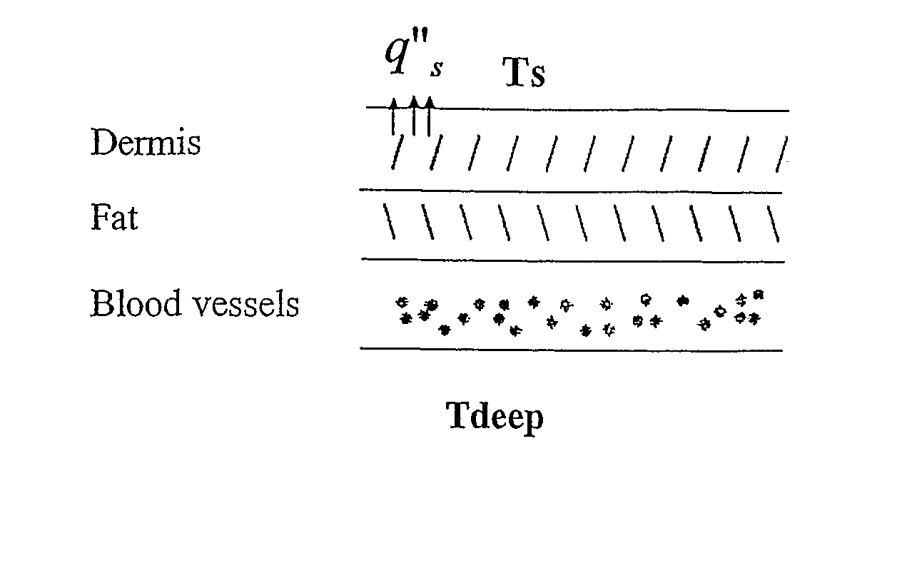 Temperature Measurement Device