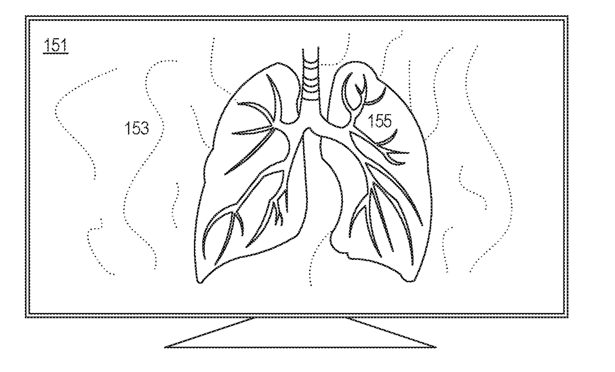 Simultaneous visible and fluorescence endoscopic imaging