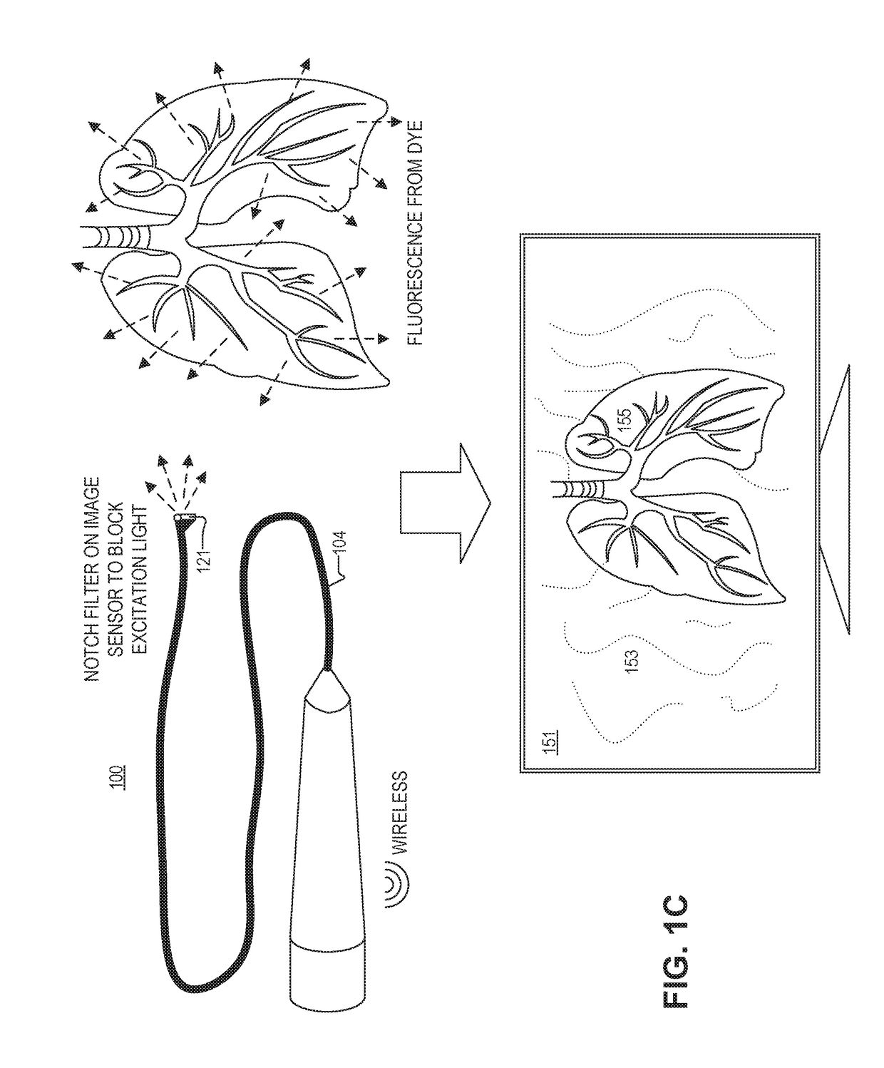 Simultaneous visible and fluorescence endoscopic imaging